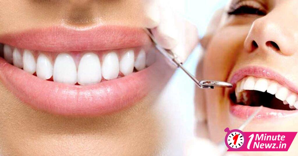 4 tips to keep away dental problems